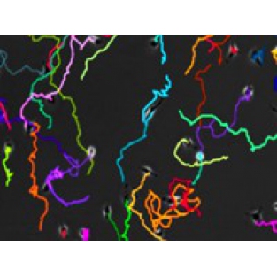 细胞趋化追踪轨迹分析Chemotaxis Image Analysis